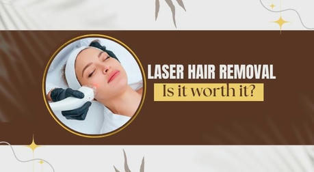 Is Laser Hair Removal Worth It? Here's What You Should Consider ✨